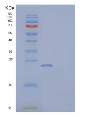 Recombinant Mouse IGF Binding Protein 6/IGFBP-6 Protein(C-6His)