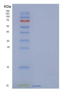 Recombinant Human C-X-C Motif Chemokine 1/CXCL1 Protein(C-6His)