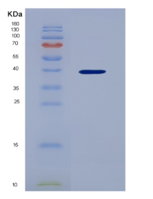 Recombinant Chemokine (C-X-C Motif) Ligand 3 (CXCL3).
