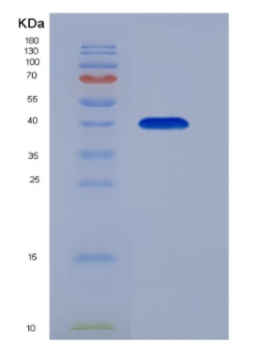 Eukaryotic Cluster Of Differentiation 23 (CD23)