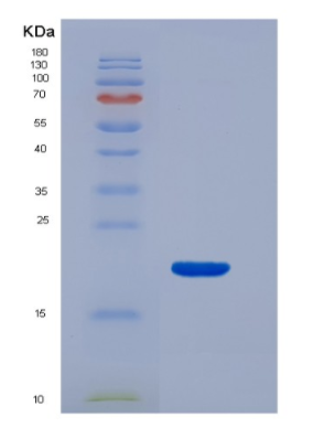 Eukaryotic Transforming Growth Factor Beta 1 (TGFb1)
