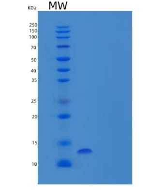 Recombinant Human Bone Marrow Stromal Antigen 2 Protein