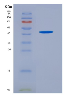 Recombinant Interleukin 33 (IL33).