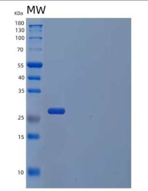 Recombinant Human Tyrosine-Protein Kinase Receptor Tie-1/Tie-1 Protein(C-6His)