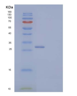 Recombinant Human Vesicular Integral-Membrane Protein VIP36 Protein