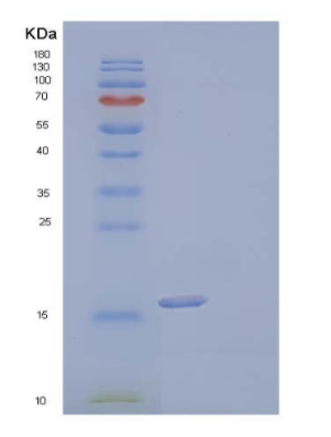 Recombinant Human Interleukin-17F/INHAProtein(C-6His)