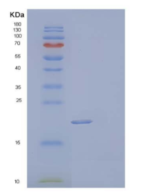 Recombinant Mouse Lithostathine-2/Reg2 Protein(N-6His)
