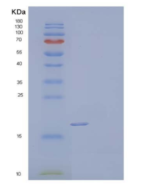 Recombinant Human Interleukin-1β/IL-1β Protein