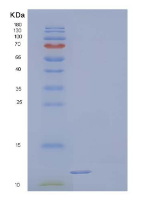 Recombinant Human Podoplanin/PDPN/Aggrus Protein(C-6His)