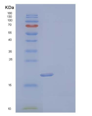 Recombinant Human Uridine Phosphorylase 1/UPP1 Protein(N-6His)