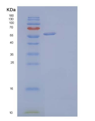 Recombinant Human Dickkopf-Related Protein 2/DKK-2 Protein(N-Fc, C-6His)
