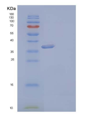 Recombinant Human Aldo-Keto Reductase 1C3/AKR1C3 Protein(C-6His)