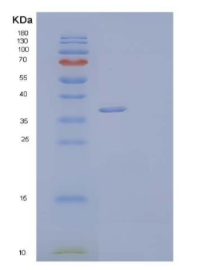 Recombinant Human Dickkopf-Related Protein 3/DKK3 Protein(C-6His)