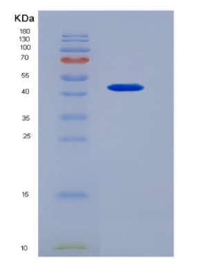 Recombinant Interleukin 3 (IL3)
