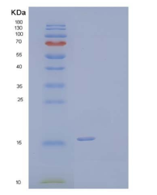 Recombinant Human Vasoactive Intestinal Peptide/VIP Protein(C-6His)