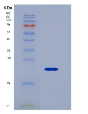 Eukaryotic Interleukin 4 (IL4).
