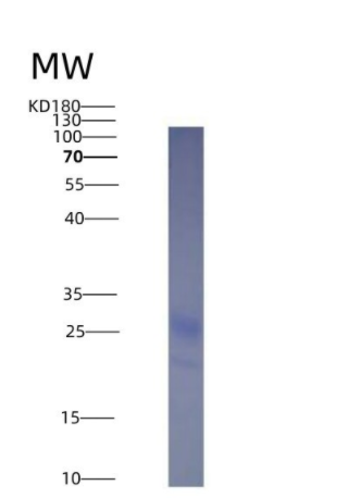 Eukaryotic Tumor Necrosis Factor Ligand Superfamily, Member 4 (TNFSF4)