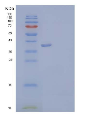 Recombinant Human Annexin A2/ANXA2 Protein