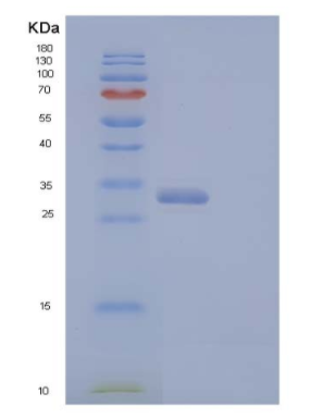 Recombinant Human V-Set and Ig Domain-Containing Protein 8/VSIG8 Protein(C-6His)