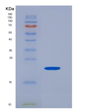 Recombinant Human CD32a / FCGR2A Protein (166 Arg, His tag)