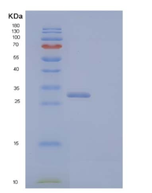 Recombinant Human Chymotrypsin-C Protein