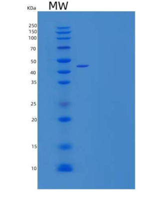 Recombinant Human B3GNT1 Protein(C-6His)