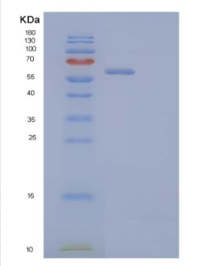Recombinant Human Leucine-Rich α-2-Glycoprotein/LRG1 Protein(C-Fc-6His)