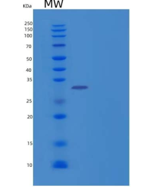 Recombinant Human β-1,3-Glucuronyltransferase 3/B3GAT3 Protein(C-6His)
