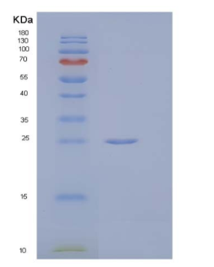 Recombinant Human Butyrophilin 1A1/BTN1A1 Protein(C-6His)
