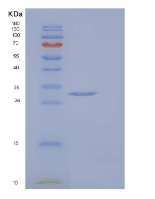Recombinant Human δ(3,5)-δ(2,4)-Dienoyl-CoA Isomerase, Mitochondrial/ECH1 Protein