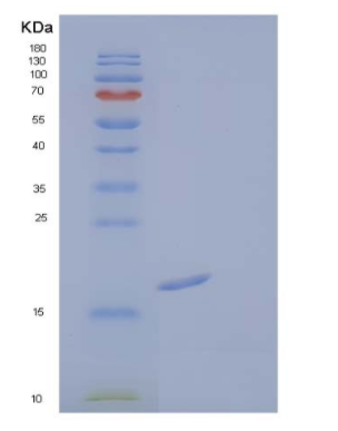 Recombinant Human Fibroblast Growth Factor 1/FGF-1/FGFa(Ala2-Asp155) Protein