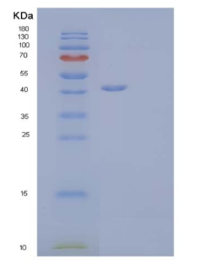 Recombinant Human Lymphotactin/LTN/XCL1 Protein(C-Fc-6His)