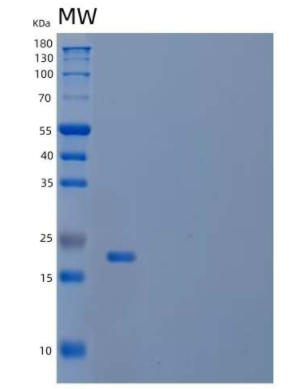 Recombinant Human LYVE-1/HAR/XLKD1 Protein(C-6His)