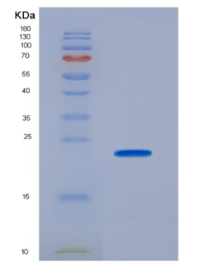Recombinant Fibroblast Growth Factor 4 (FGF4)