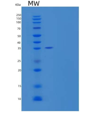 Recombinant Human Methionine Aminopeptidase 1D/MetAP1D/MAP1D Protein(N, C-6His)