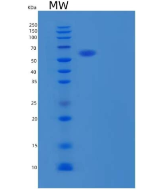 Recombinant Human GALNTL1 Protein(C-6His)