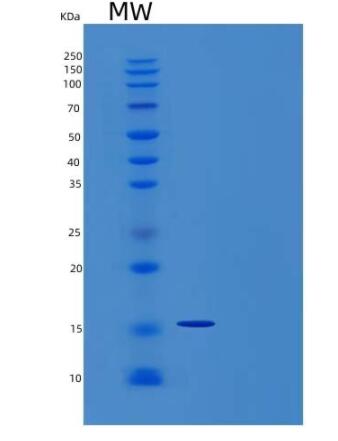 Recombinant Human Interleukin-4/IL-4 Protein