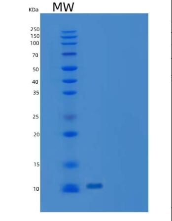 Recombinant Human C-C Motif Chemokine 16/CCL16 Protein