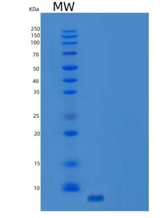 Recombinant Human C-C Motif Chemokine 3/CCL3 Protein