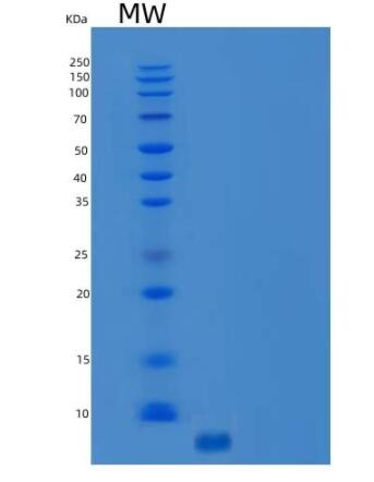 Recombinant Human C-C Motif Chemokine 5/CCL5/RANTES Protein