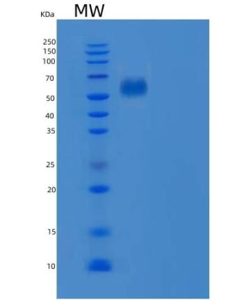 Recombinant Human EphB6 / EphB6 Protein
