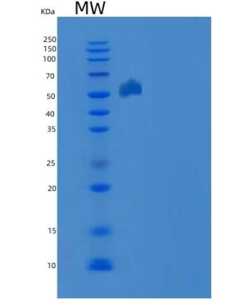 Recombinant Mouse EphA2 Protein (His tag)