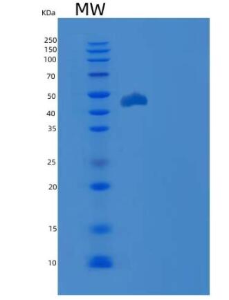 Recombinant Human CDKN2D / p19ink4d Protein (GST tag)
