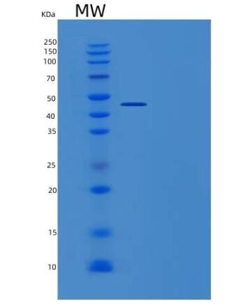 Recombinant Human APOM Protein (Fc tag)