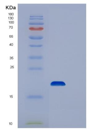 Recombinant Human UBC9 Protein