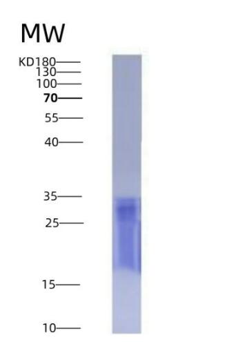 Eukaryotic Tetraspanin 30Cluster of Differentiation 63 (CD63)