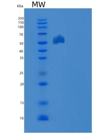 Recombinant Mouse EphB3 / HEK2 Protein (His tag)