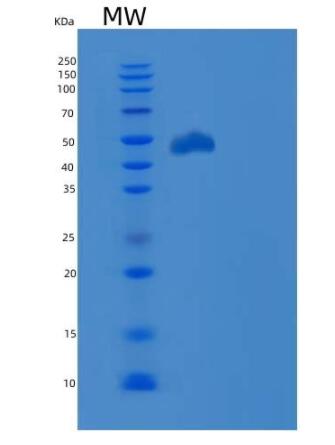 Recombinant Human PD-L1 / B7-H1 / CD274 Protein (ECD, Fc Tag)