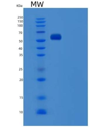 Recombinant Human Serum Albumin / HSA / ALB Protein