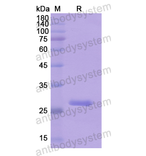 Recombinant Human ABCC4, N-His